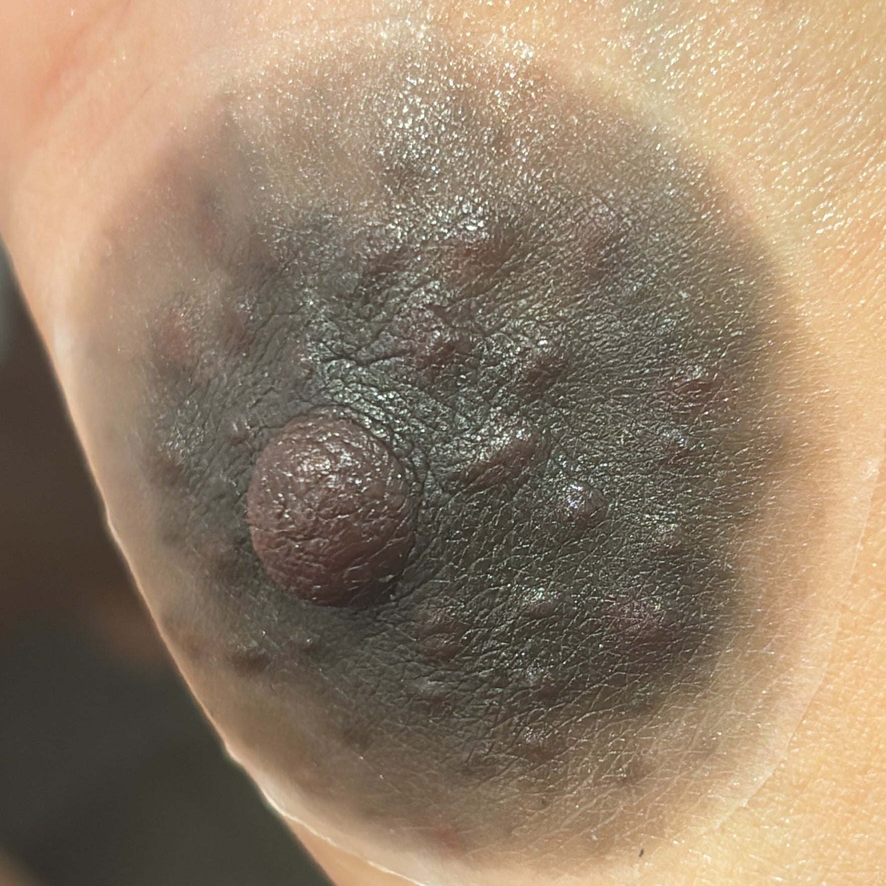 Restore Your Confidence Today – Ultra-Realistic Areola Prosthetics