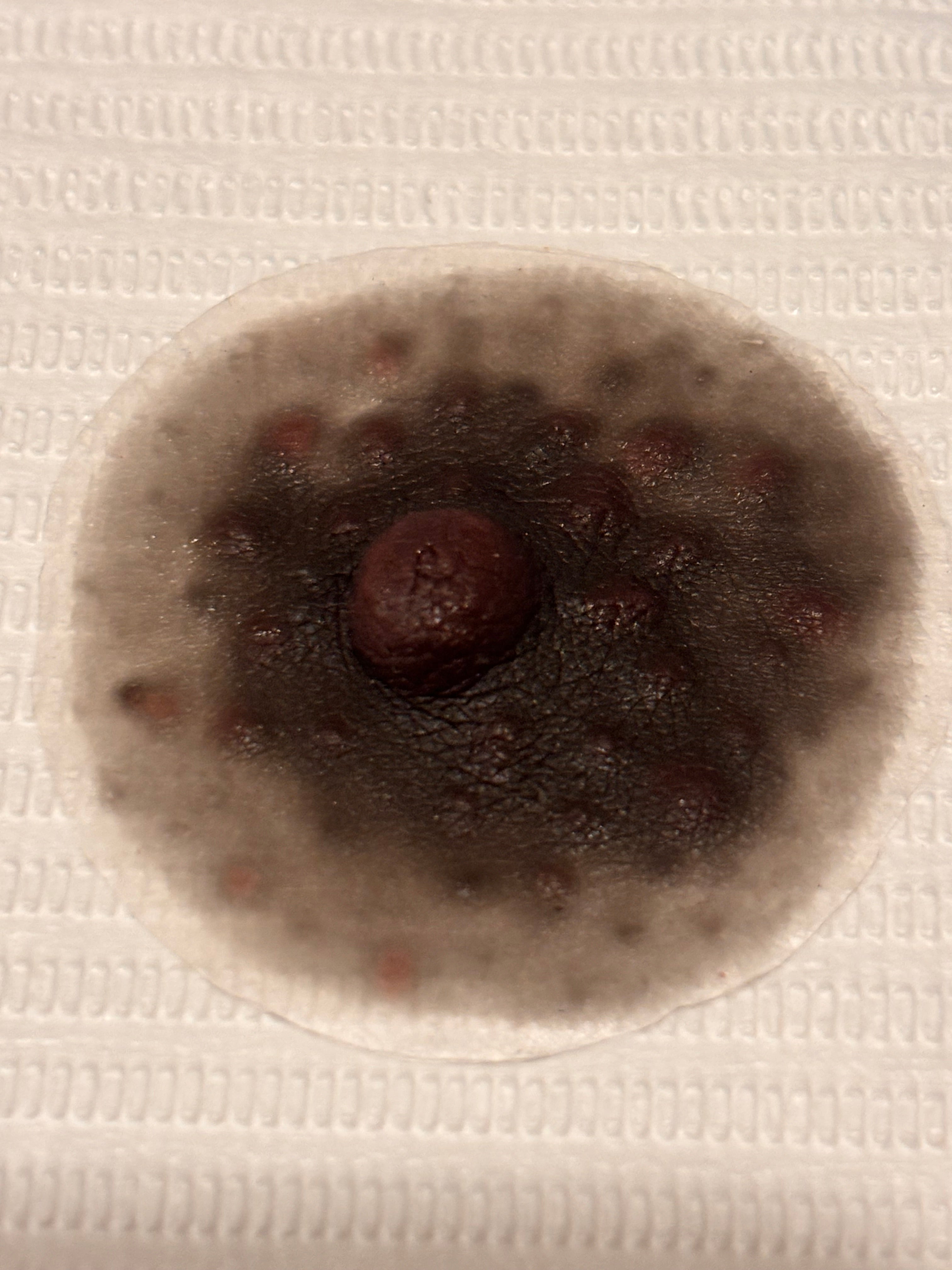 Restore Your Confidence Today – Ultra-Realistic Areola Prosthetics