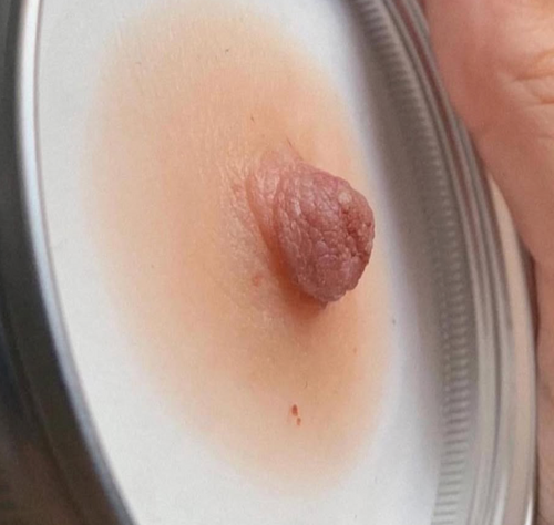 Confidence, Beauty & Comfort – Areola Prosthetics That Change Lives