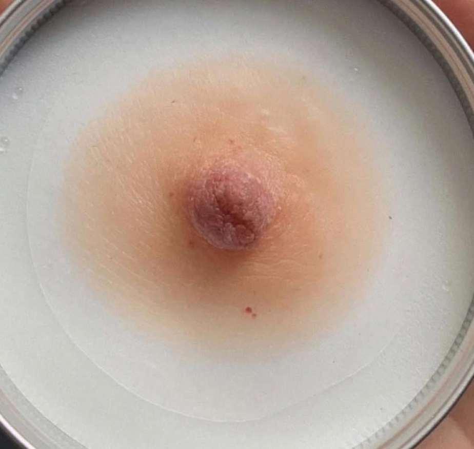 Confidence, Beauty & Comfort – Areola Prosthetics That Change Lives