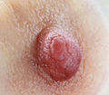 Confidence, Beauty & Comfort – Areola Prosthetics That Change Lives